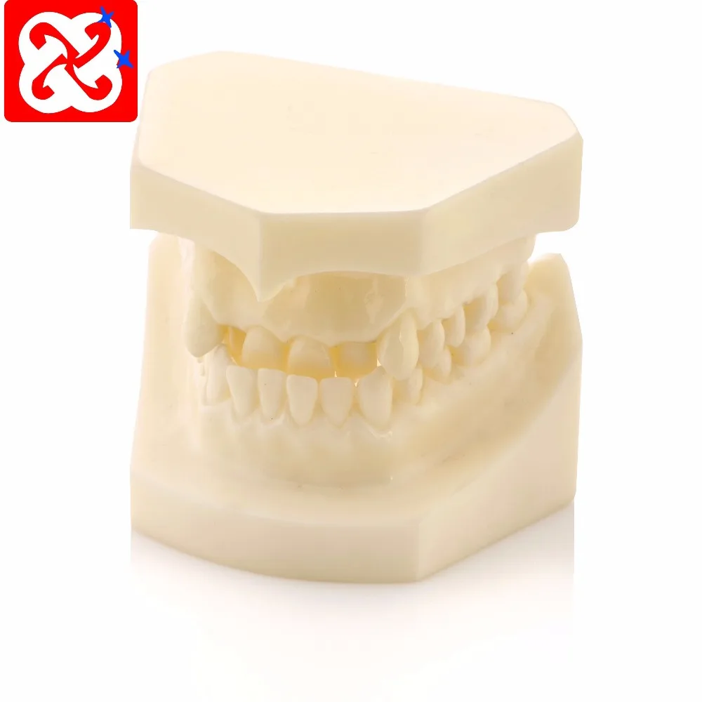 Different malocclusion and occlusion classification dental model 10 kinds orthodontic practice model