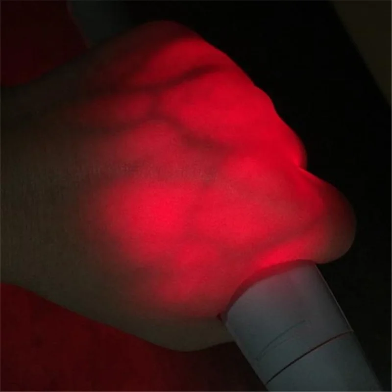 Cheap LED Vein Finder With Visual Vein Portable Vein Locator