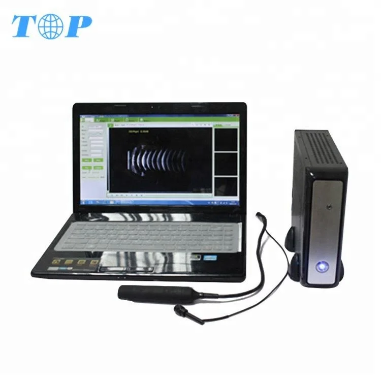 Top Sale Laptop Ophthalmic AB Mode Ultrasound Scanner Equipment, Ophthalmic A Scan And B Scan Ultrasound For Eye