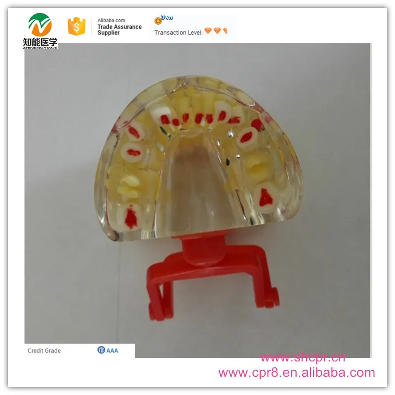 BIX-L1006 Transparent baby teeth pathological dental model