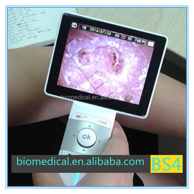 3.5 inch Color Screen Otoscope Endoscope Parts Handheld ENT Inspection Equipment With CE Certificate