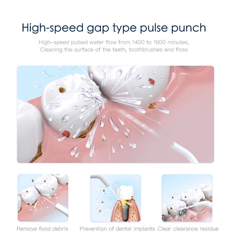 Электрический массажер, Стоматологический Ирригатор, резинка, мягкий очиститель воды