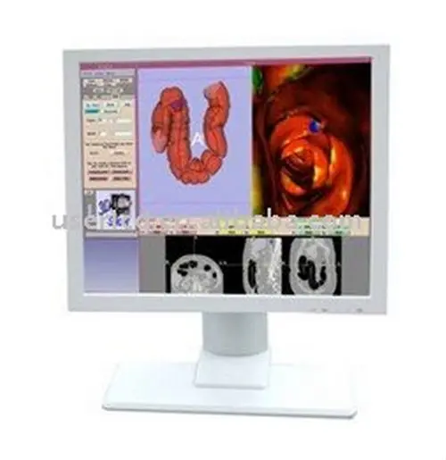 17 дюймов медицинской cctv монитор для gastroscope