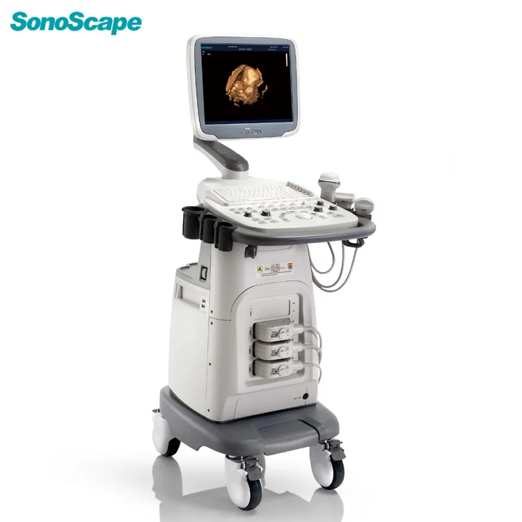 SonoScape S11 Color Doppler Diagnostic Ultrasonic Medical Equipment