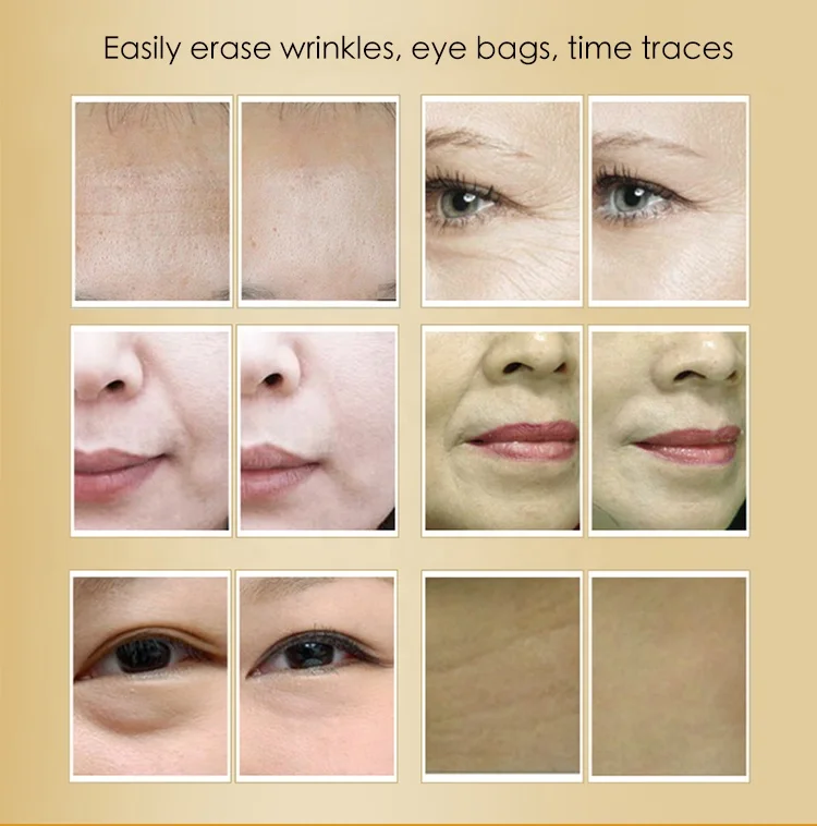 OEM professional skin care instant ageless eye bag removal firming lifting wrinkle filler cream in 2 minutes