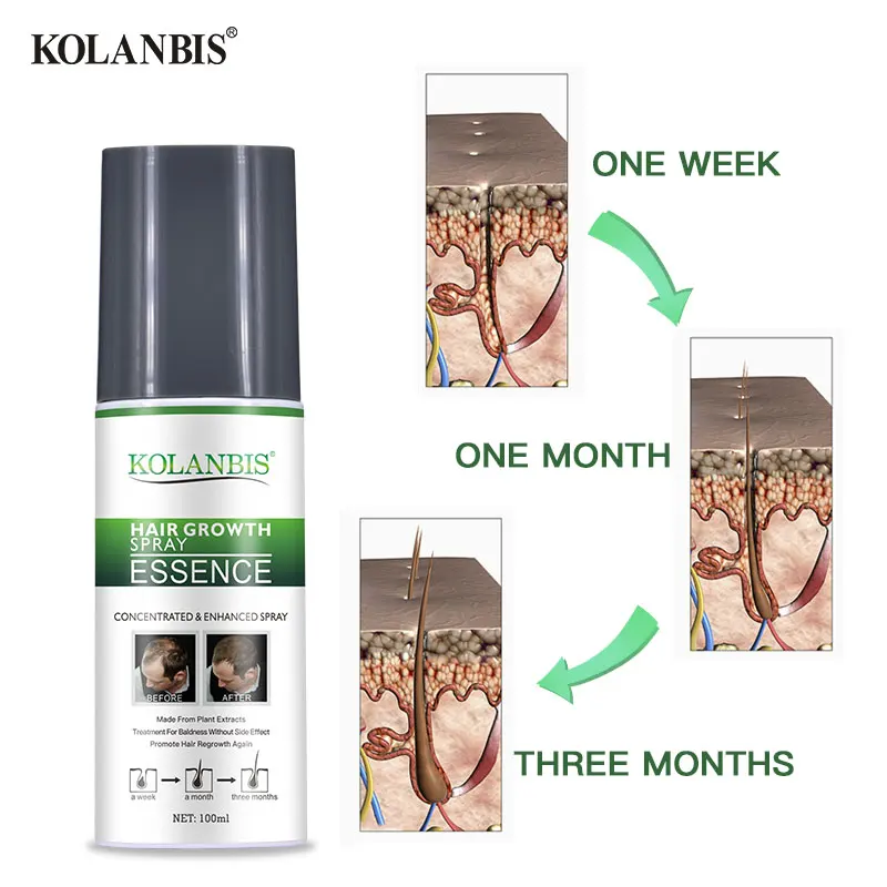 100 ML Hot selling whole sales hair growth serum for female and male