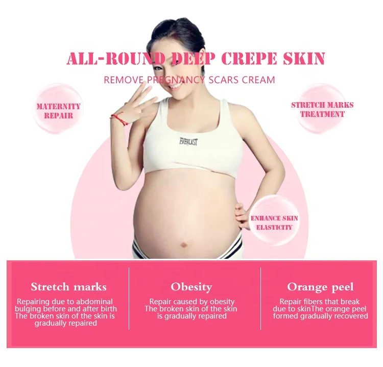 Water Ice Levin brand Herbal extract maternity skin repair remove Pregnancy Stretch Marks Scars Essential oil