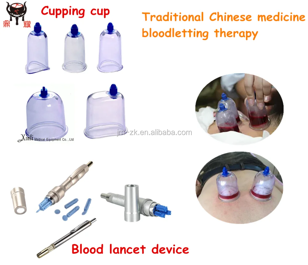 Plastic Healthy Cupping Set (Manufacturer) CE approved hijama kit