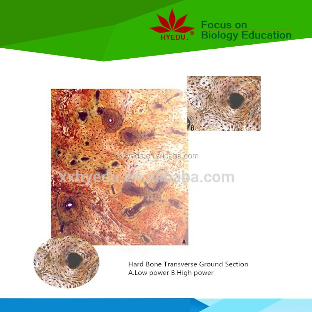 Most popular fixed set 100pcs set wooden box histology slides,human histology slides,Animal histology slides