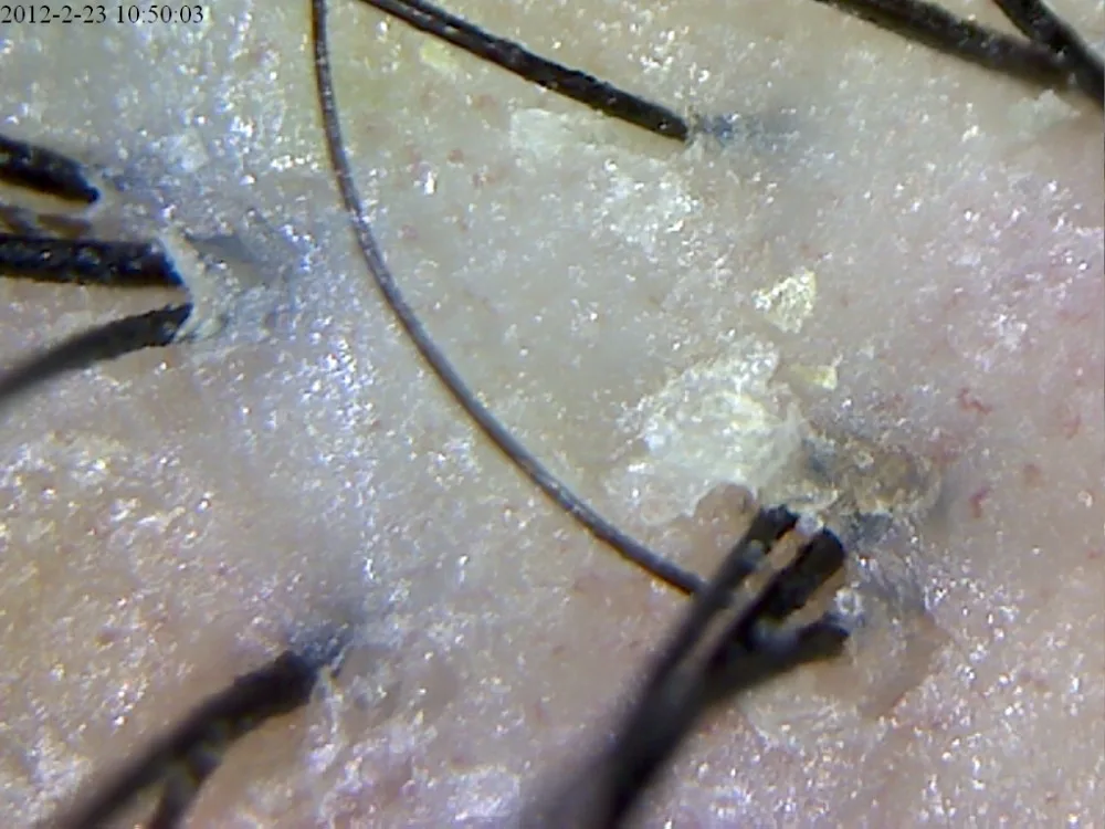 Portable USB Mini Dermatoscope With 8 LED lights