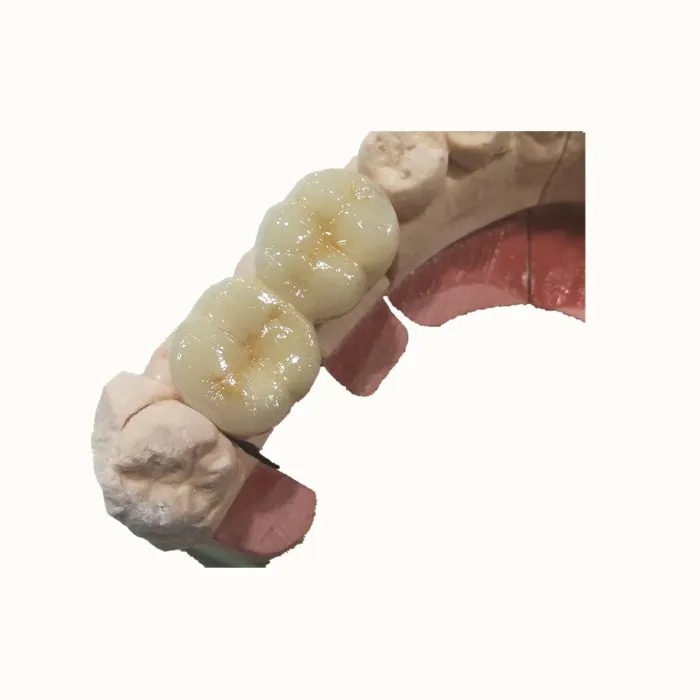
Good metal and porcelain false teeth 