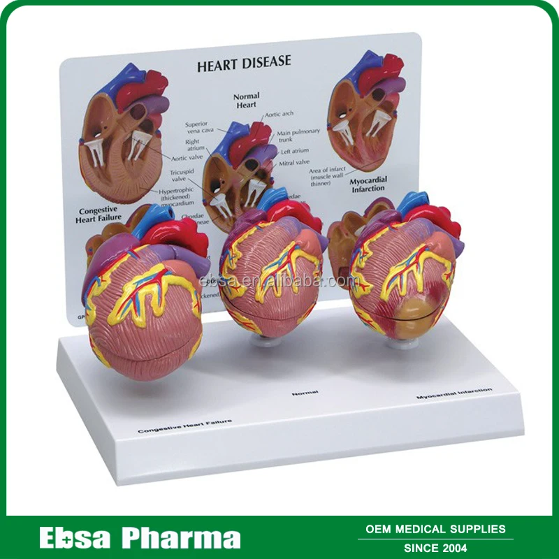 Advanced Medical Supplies Human Teaching Heart Anatomical Model For Medical School