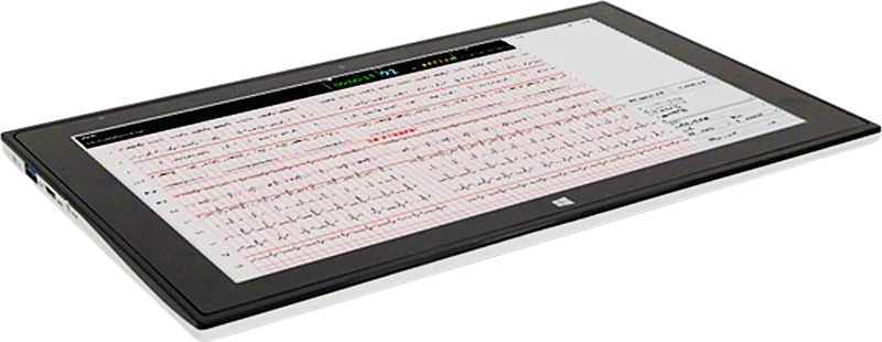 
Resting 12 channel Tablet PC Resting ECG 