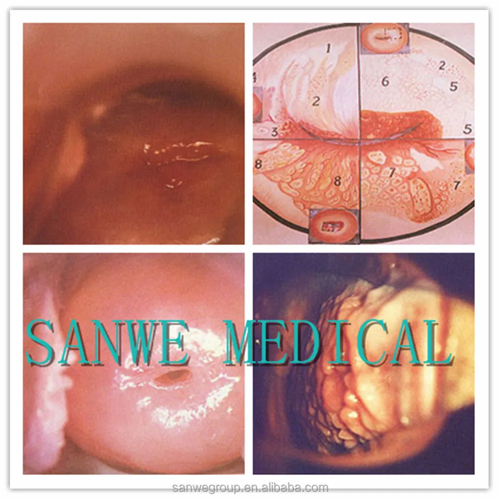 SW-3304 Digital Video Colposcope, Vaginal Colposcope with Camera, Video Colposcope