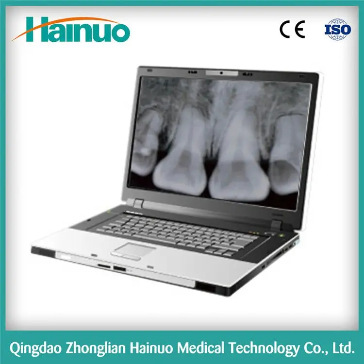 
Hot Sale HDR Intraoral Digital X-ray Radiologic Dental 