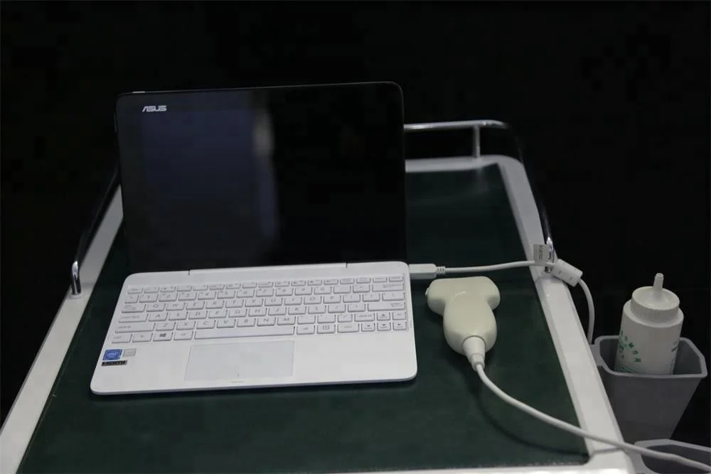 Low price High quality portable tablet ultrasound probe USB interface convex and linear probe scanner