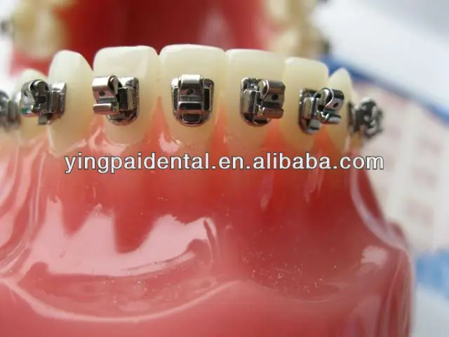 Ортодонтический стоматологический металлический кронштейн оптовая цена