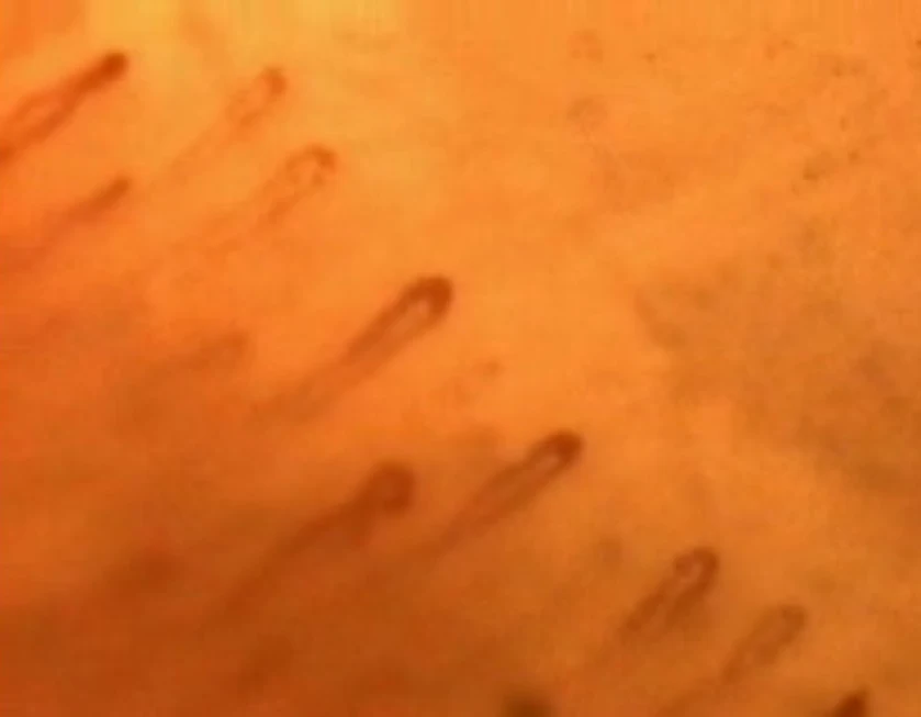 LCD Screen Digital Capillary Microcirculation Microscope