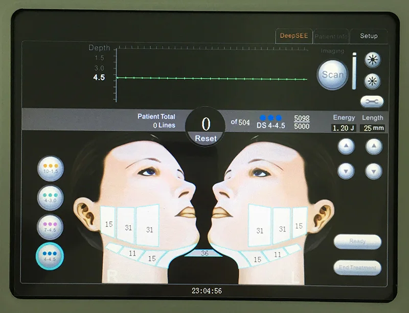 HOT!!cheap price portable SMAS skin tightening mini hifu anti aging ultrasound device with 5 cartridges Yting machine