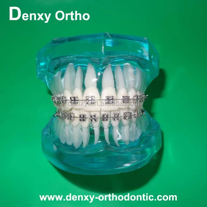 
High-quality beautiful dental supplier transparent orthodontic model 