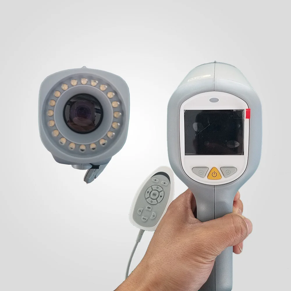 CE passed KN-2200A colposcopy machine digital video colposcope for gynecology examination