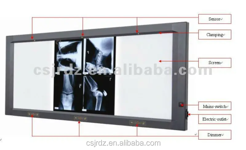
LED X ray medical view box Double panel JD 01BIII Jinde X ray film viewing box 