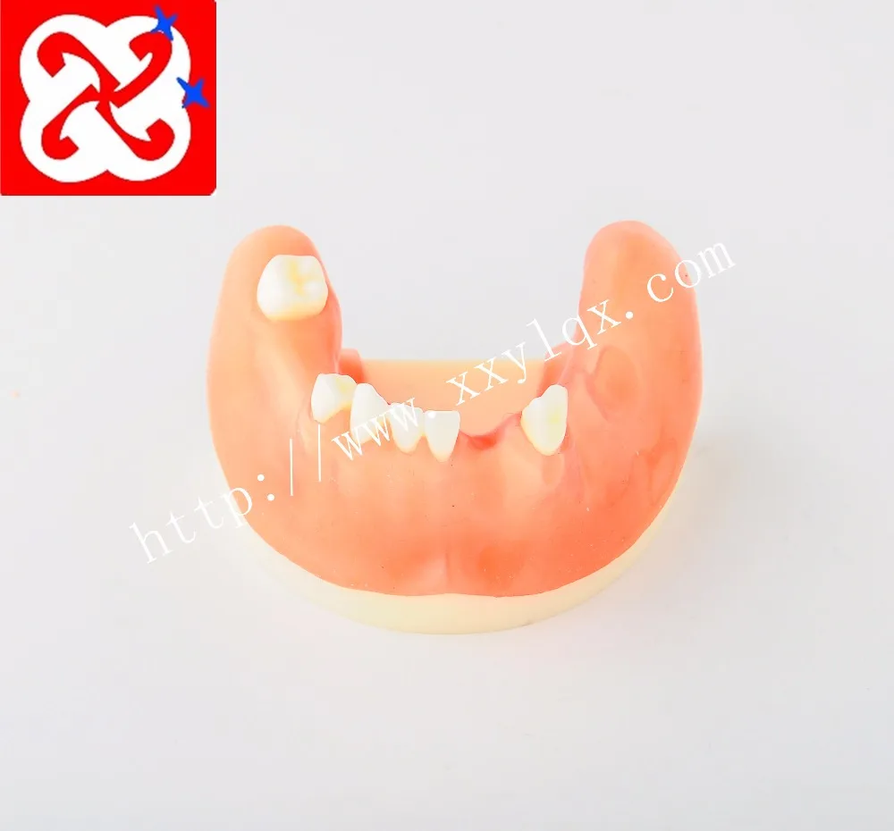 implant practice denta model for cutting, suturing in different teeth missing lower half
