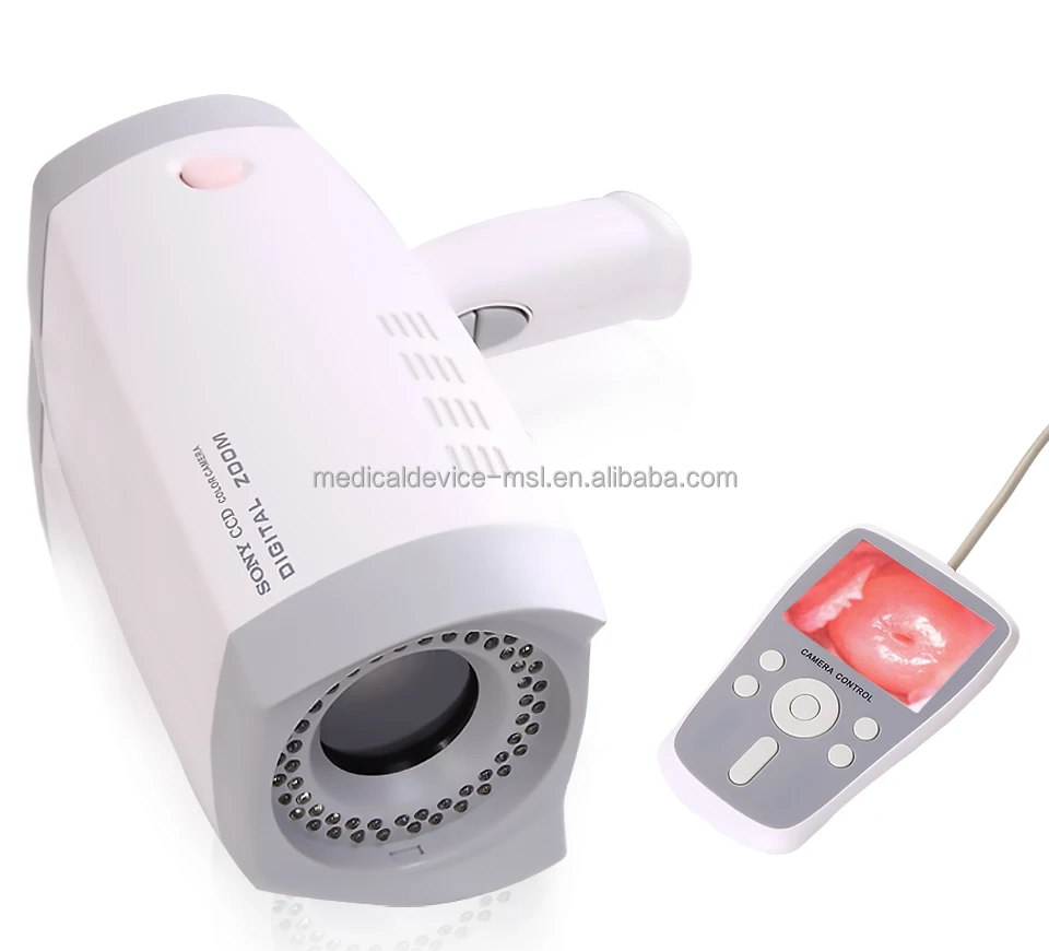 
China Best Price for Handheld Portable Color Digital Video Colposcope for vulva, vagina and cervix diagnostic - MSLCE04 