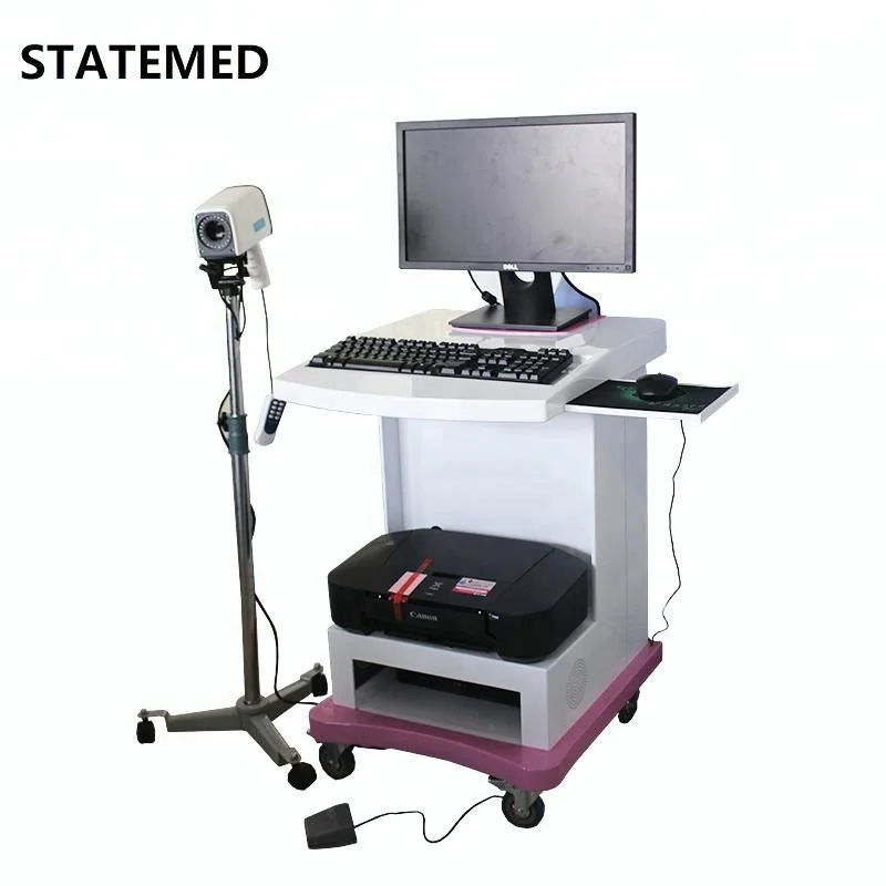 Hot selling mini digital colposcope for gynecology