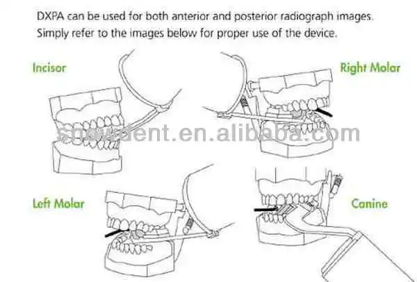 Supply Dental X-Ray Sensor Positioner wholesale