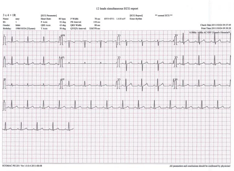 
PC based ECG Windows PC ECG mini ECG 