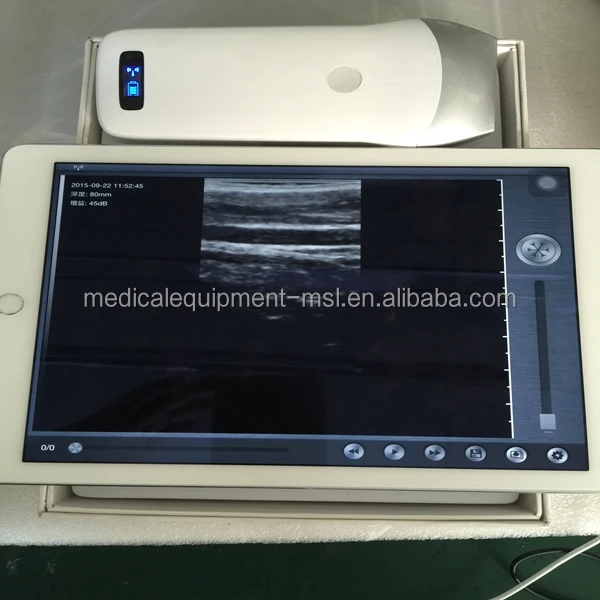 Большая Акция, недорогой беспроводной линейный зонд, ультразвуковой аппарат, портативный сканер MSLPU35/41/42