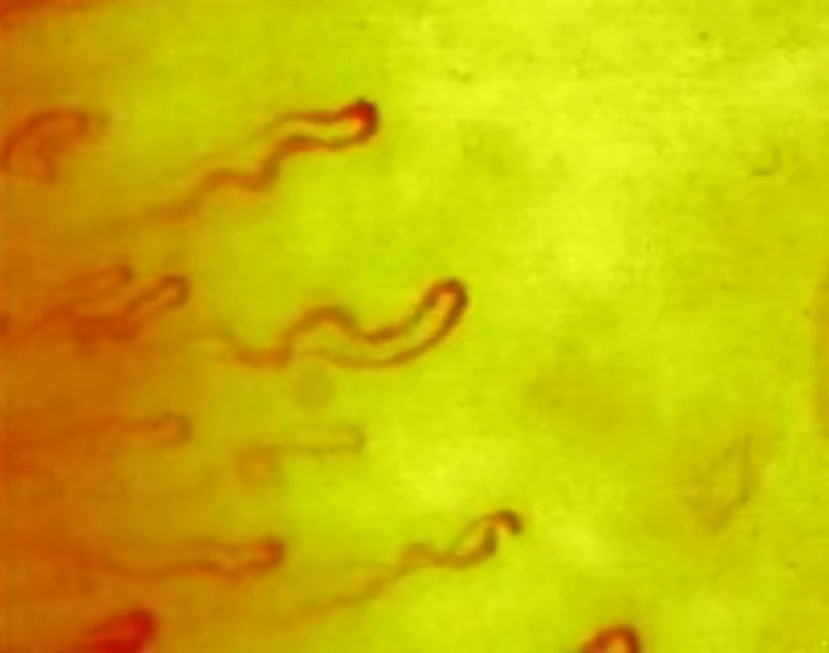 LCD Screen Digital Capillary Microcirculation Microscope