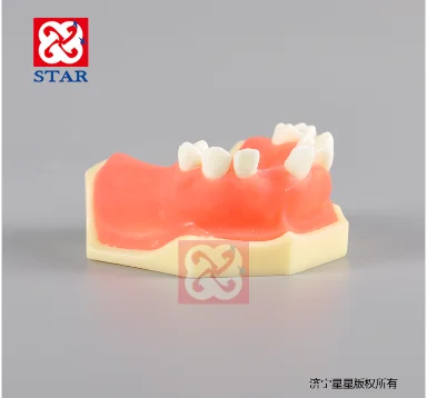 Sinus lift practice model implant model