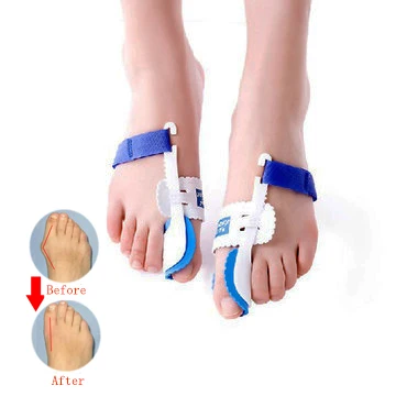 Medicus Fixture Bunion Hallux Valgus Corrector Toe Separator, Bunion Night Splint Hallux Valgus