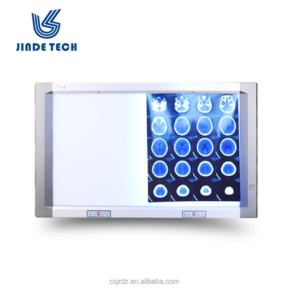 
High quality Double LED x-ray light box medical negatoscope price 