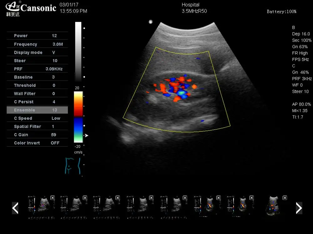 Manufacture price 4d portable color doppler ultrasound