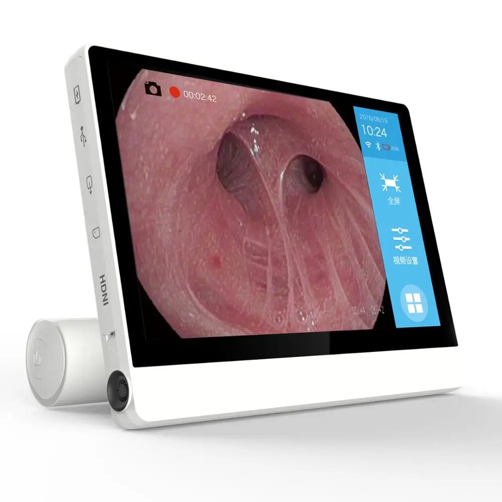 Full HD portable ENT video endoscope/endoscope video camera