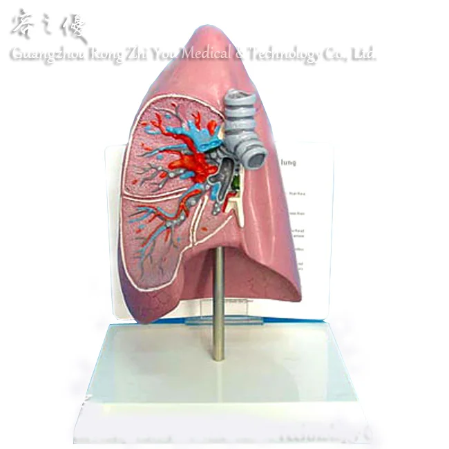 R090207 Medical Anatomy Human Body Parts Disease Lung Model