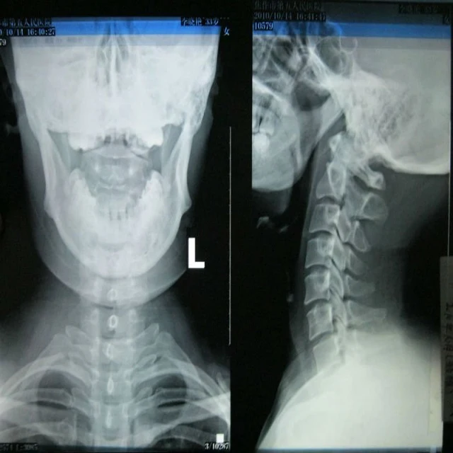 fuji di-hl dry laser imaging film 8 x 10 (20 x 25cm)