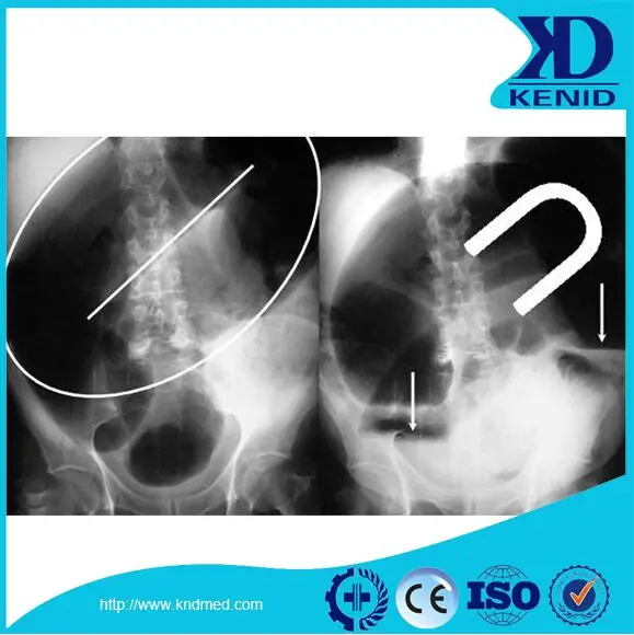 
KND A/F Dry X Ray Film for DSA/MRI Agfa Medical Fuji Diat Thermal Flim 