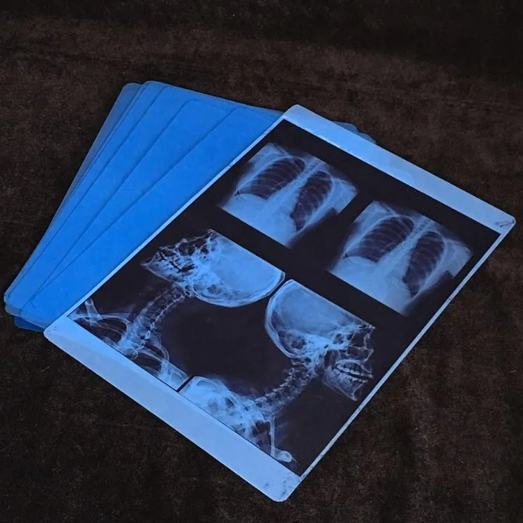 8*10 Inch Blue Base Inkjet Printing X Ray Medical Film