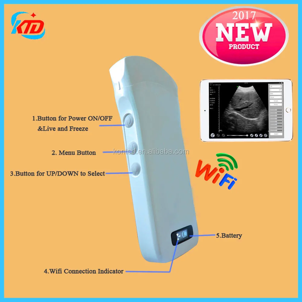 Беспроводной ультразвуковой зонд Ipad с 128 элементами, ультразвуковой сканер для теста на беременность