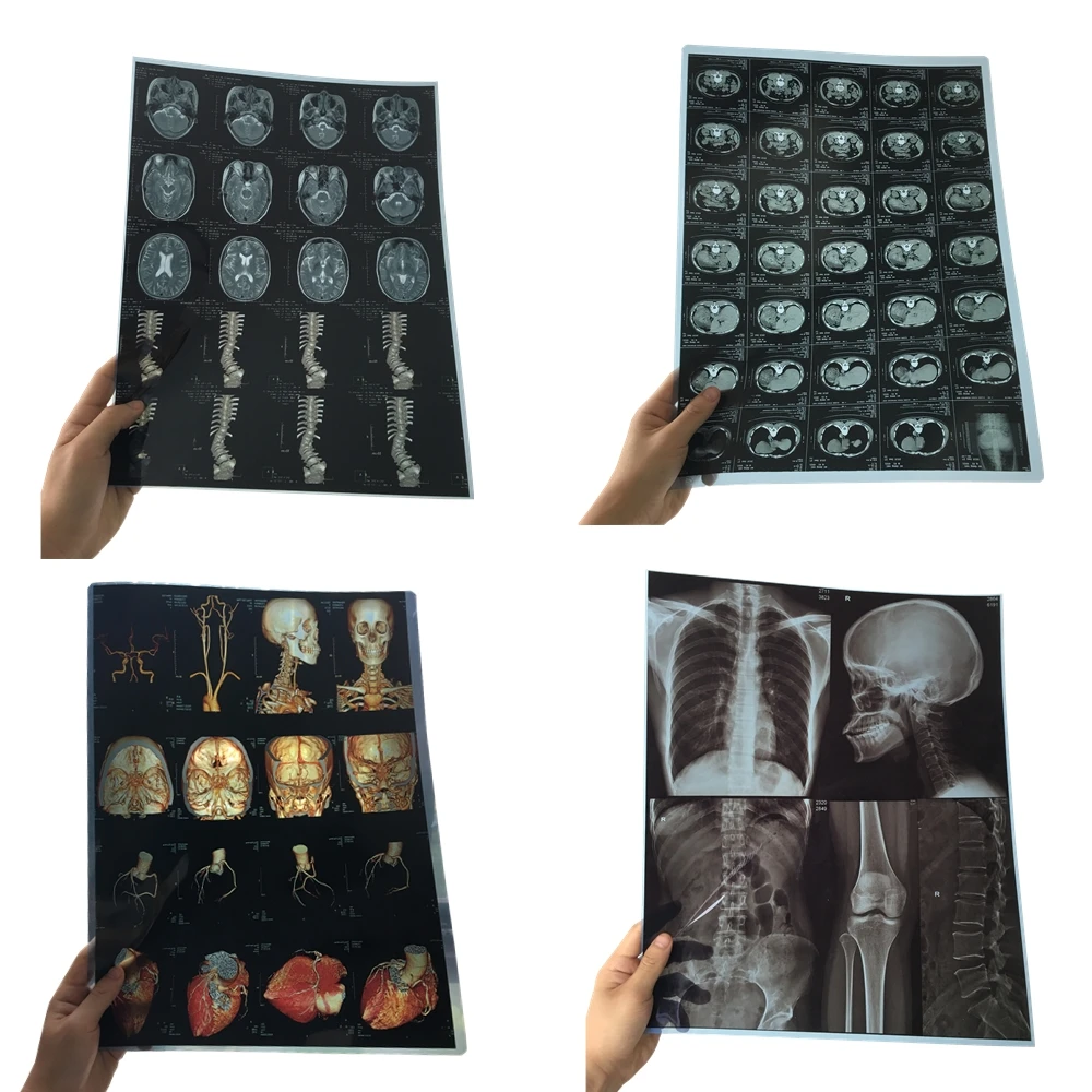 China Inkjet Printing Medical Imaging Film/Agfa Medical Thermal Films