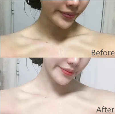 Фирменный отбеливающий лосьон для черной кожи и тела, крепкий отбеливающий крем для кожи