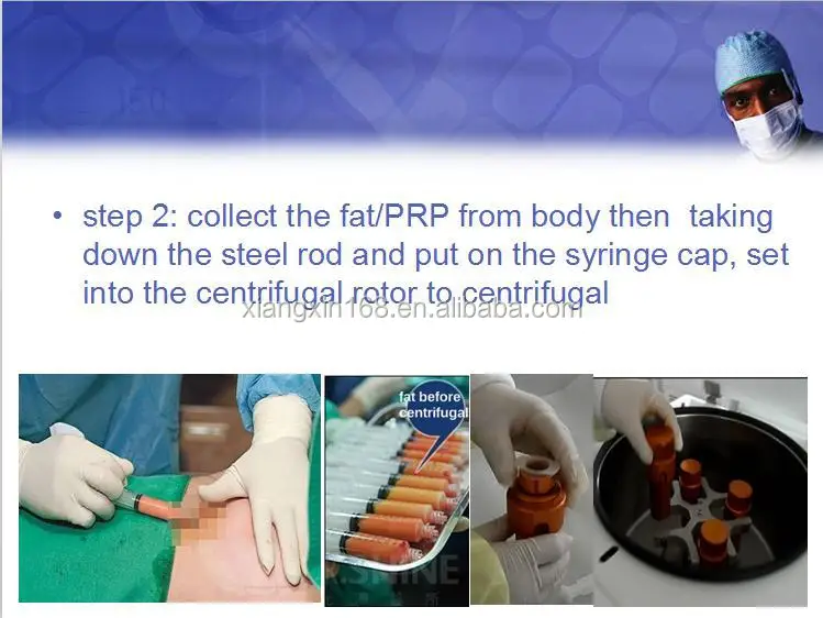 advance sealed caps syinges fat and blood plasma extract centrifuge TD4-MR