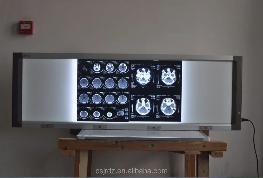 X-Ray film viewer JD-01DIII Brightness adjustable and Film sensor