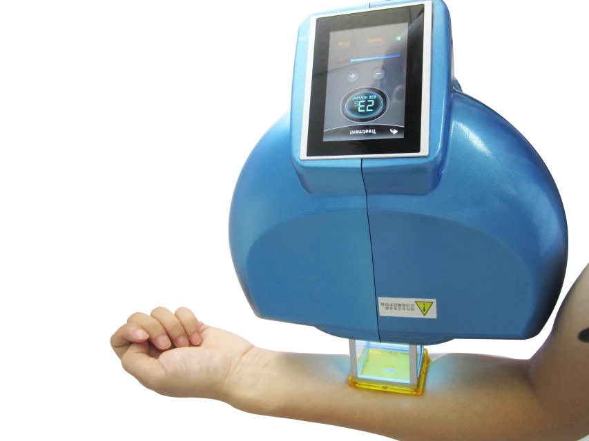 Wholesale LED Therapy Vitiligo 308nm UVB Phototherapy Diode For Cure Skin