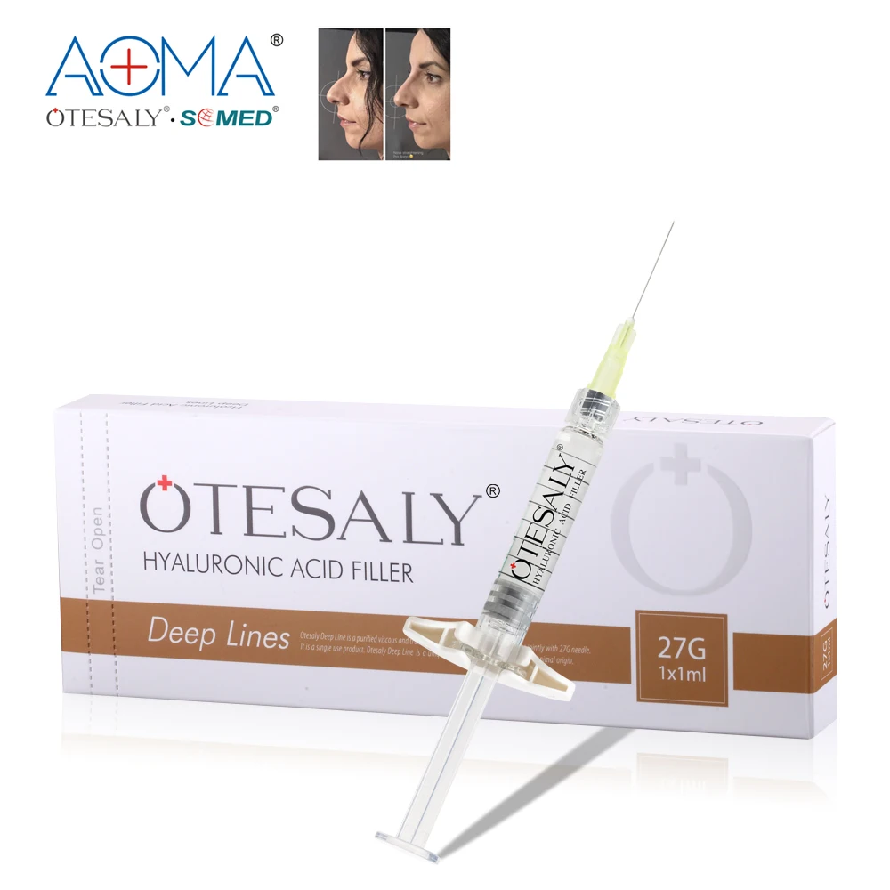 
CE Approved Otesaly 1ml deep hyaluronico acido injectable dermal filler for lips lines and fines lines 