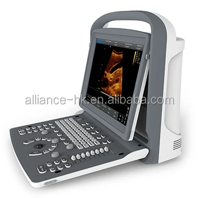 Chison ECO2 Echography Portable Black and White Ultrasound with Doppler Ecografia